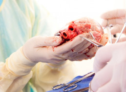 This Extraordinary Heart Transplant Technique Saves Hearts and Lives
