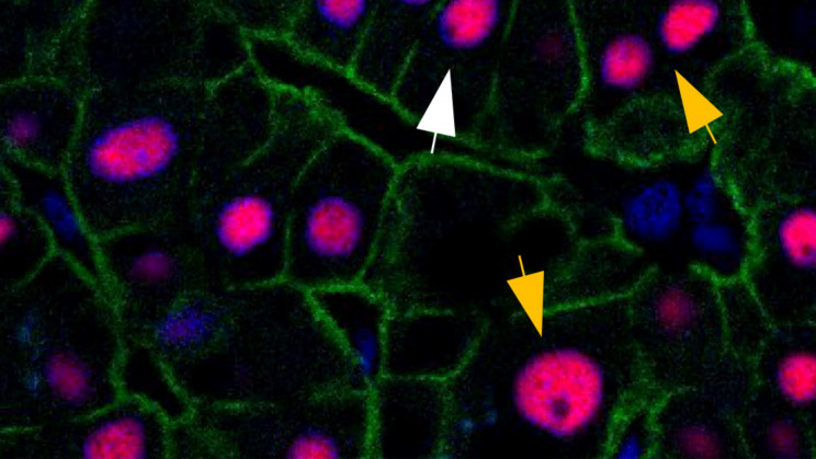 Surprise! Your liver is just 3 years old, whether you're 20 or 84