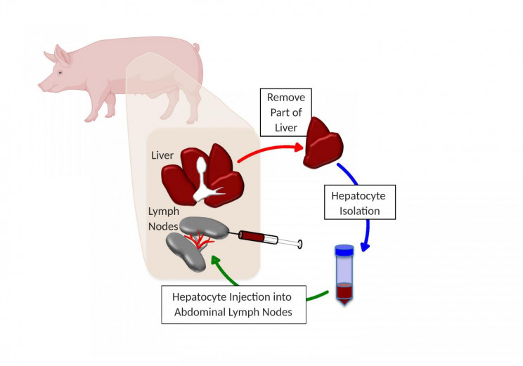 university-of-pittsburgh-liver-disease University of Pittsburgh Liver Disease