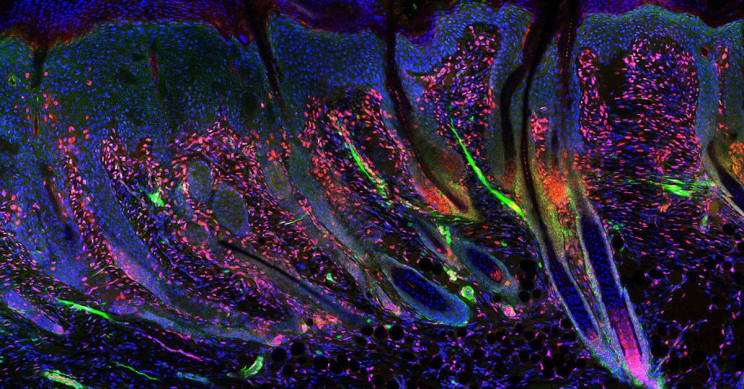 Scientists Find a Way to Regenerate Adult Skin Just Like a Baby's