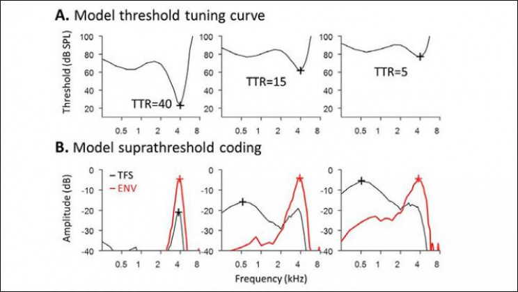 Research Highlights Different Types of Hearing Loss And Need for New Unique Treatments Research Highlights Different Types of Hearing Loss And Need for New Unique Treatments