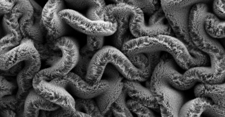 Researchers Create Stretchable Supercapacitors for Our Next Wearables