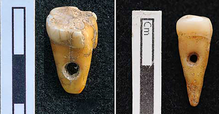 Prehistoric Humans In Turkey Used Human Teeth As Jewelry