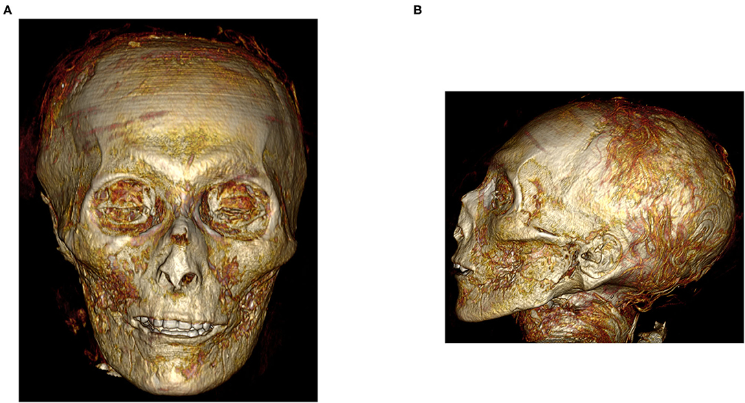 A 3,500-Year-Old Egyptian Pharaoh's Mummy Was Just Unwrapped A 3,500-Year-Old Egyptian Pharaoh's Mummy Was Just Unwrapped