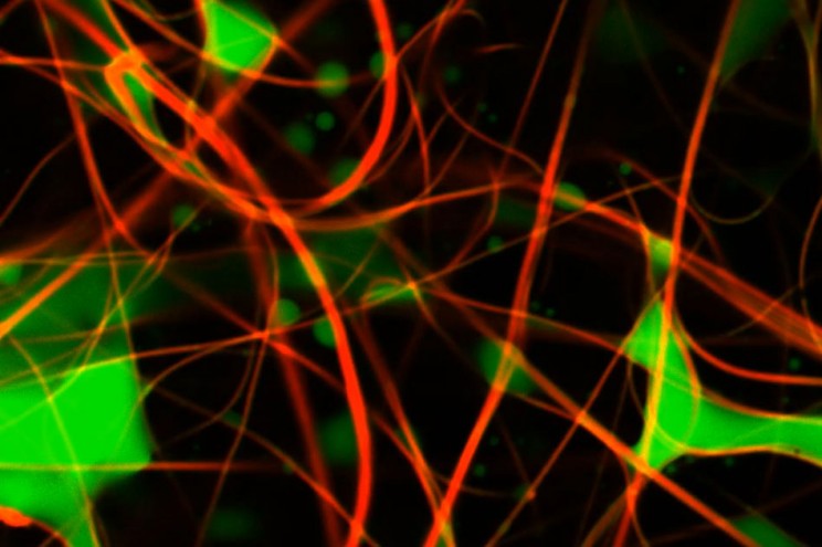 New Imaging Technique Is a Huge Breakthrough for Filtration Materials