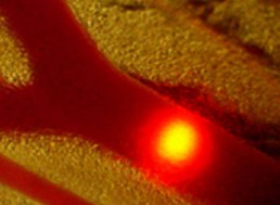 Promising Advancements in Skin Cancer Detection through Laser Use