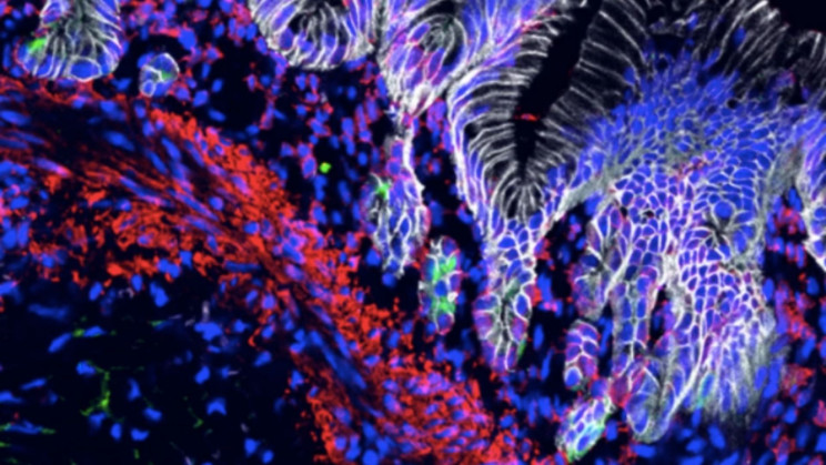 Scientists Have Grown Acid-Producing Advanced Mini-Stomachs in the Lab