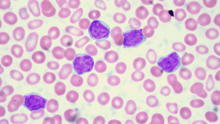 Scientists have developed a breakthrough treatment method for leukemia