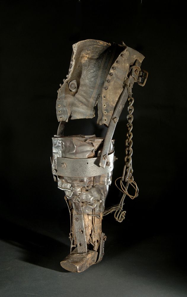 prosthetics in history miners leg
