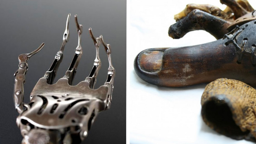 Who Invented The Prosthetic Limbs – KCCR