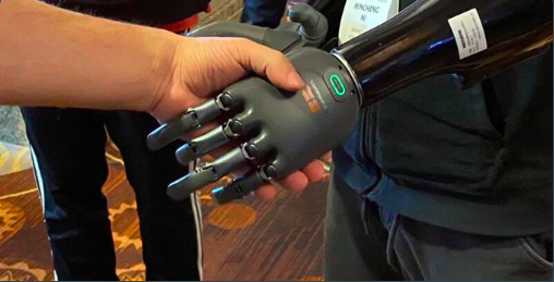 Formidable Prosthetic Hand Can Be Controlled Solely with Your Mind Formidable Prosthetic Hand Can Be Controlled Solely with Your Mind