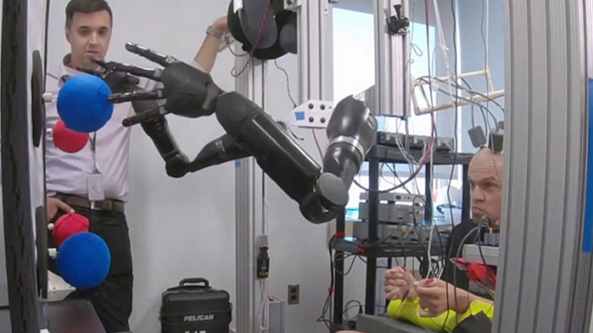 Brain Implant Allows Man to Simultaneously Control Prosthetic Limbs
