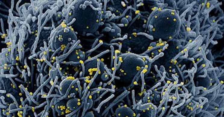 Volunteers Needed for COVID-19 Antibody Tests That Can Be Done from Home