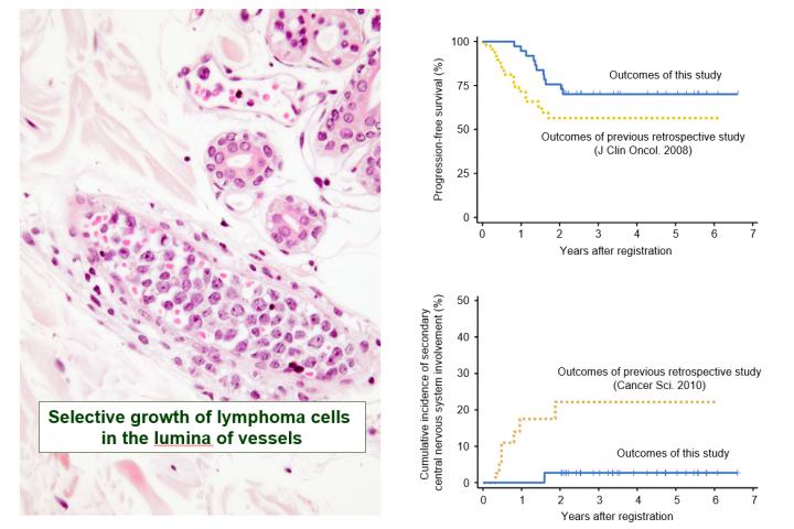 New Treatment for Rare Blood Cancer Shows Promising Results in Clinical Trial New Treatment for Rare Blood Cancer Shows Promising Results in Clinical Trial