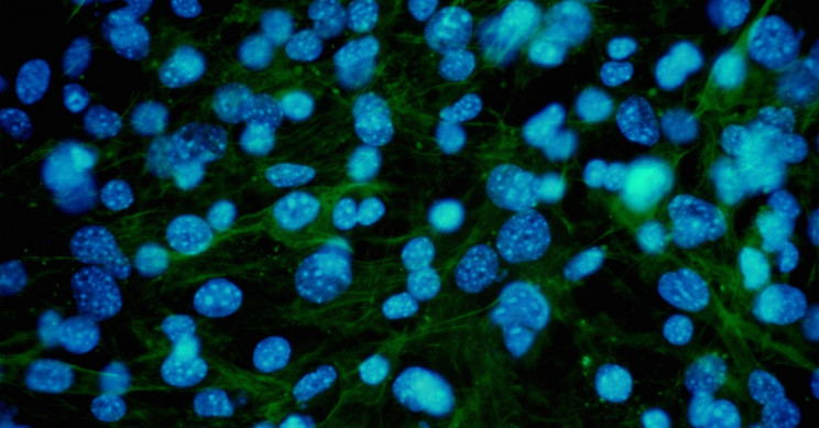 Scientists Discover New Pain-Detecting Organ Just under Our Skin
