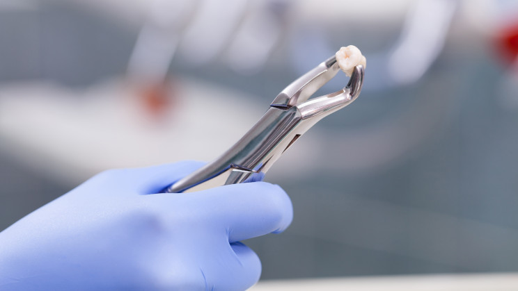 A new kind of artificial enamel is substantially stronger than the real thing