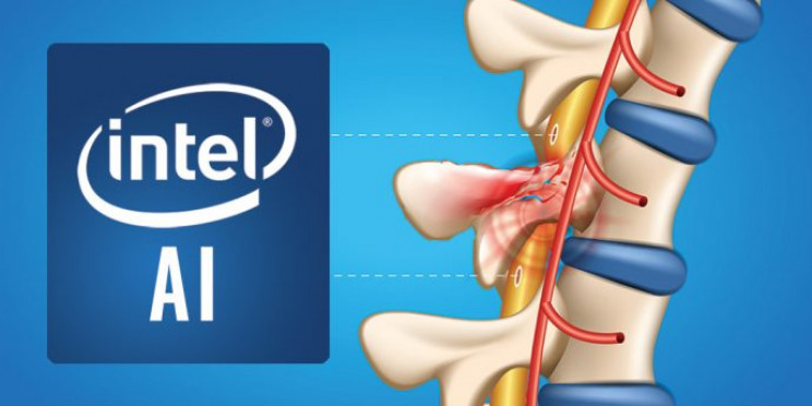 Intel and Brown University Are Developing an AI System to Help Paralyzed Patients Intel and Brown University Are Developing an AI System to Help Paralyzed Patients