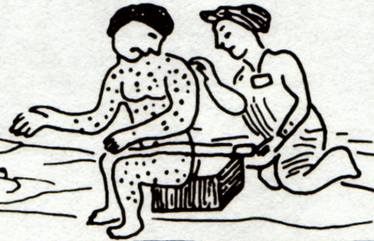 Aztec drawing of a measles sufferer Aztec drawing of a measles sufferer