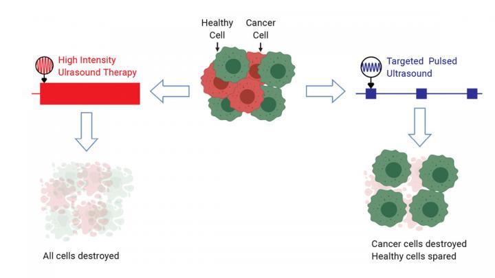 Ultrasound Can Selectively Eradicate Cancer Cells, Researchers Find Ultrasound Can Selectively Eradicate Cancer Cells, Researchers Find
