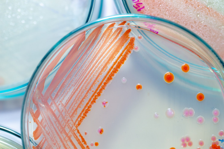 Microbial manufacturing may hold the future of sustainable urban farming.