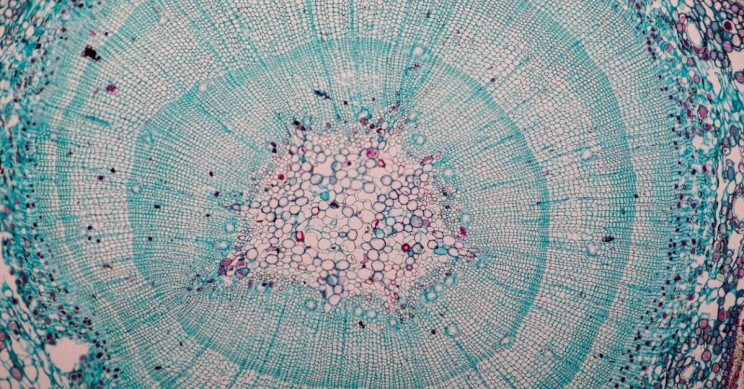 What are the Differences Between Prokaryotic and Eukaryotic Cells?