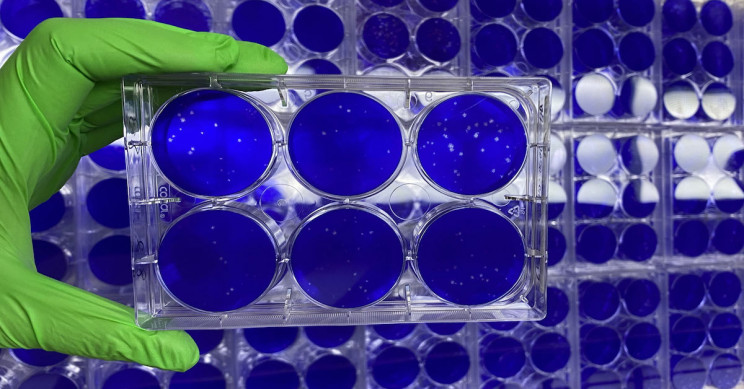 Mini Sponges Decoy the Coronavirus Before it Latches on to Lung Cells