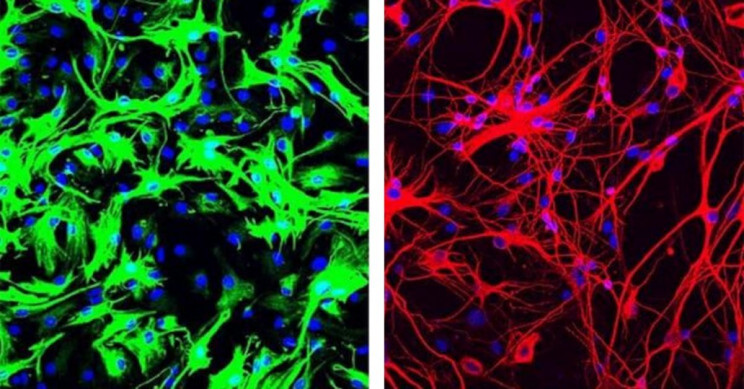 This One-Time Neuron Treatment Reversed Parkinson's Disease in Mice