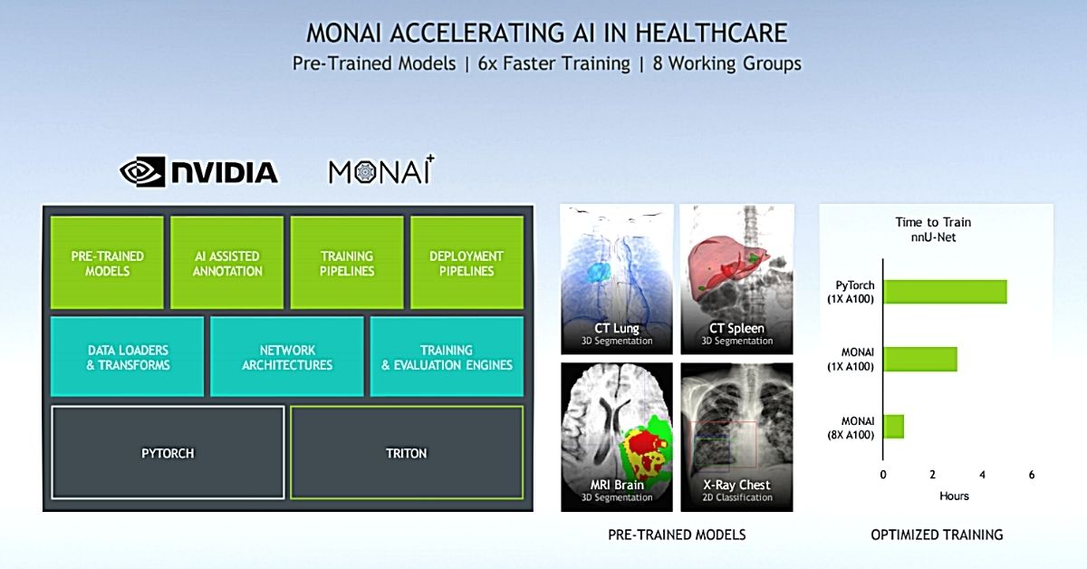 nvidia-monai-accelerating-healthcare NVIDIA MONAI Accelerating Healthcare