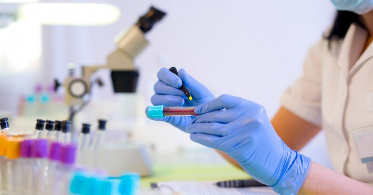 Researchers Develop a Blood Test to Detect Brain Changes From Alzheimer's