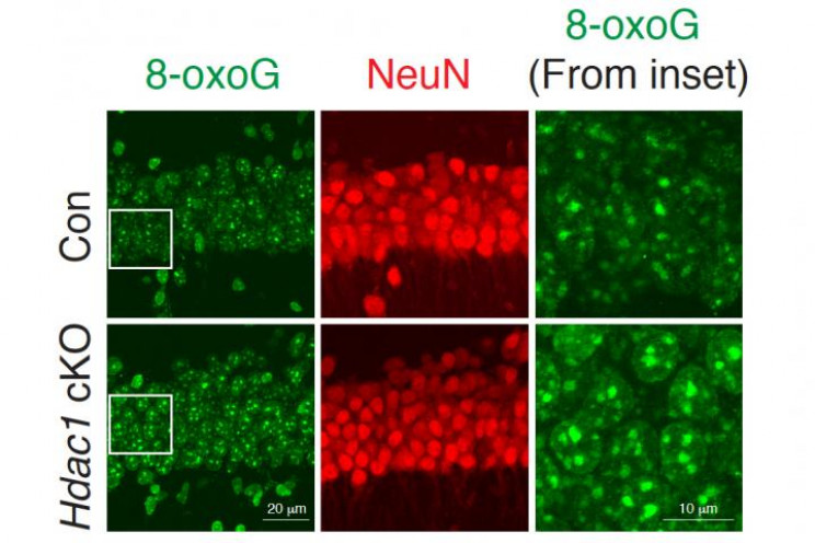 Enzyme That Could Reverse Aging Discovered by MIT Scientists Enzyme That Could Reverse Aging Discovered by MIT Scientists
