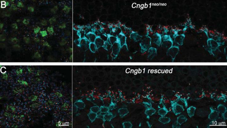 Developing Treatments for Blindness: Gene Therapy Shown to Restructure Retinas Developing Treatments for Blindness: Gene Therapy Shown to Restructure Retinas
