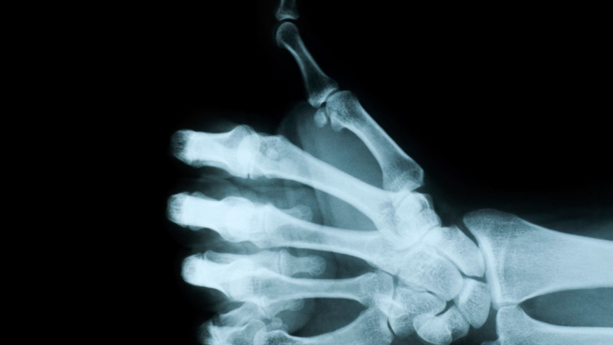 Muscles Not Present for More than 250 Million Years Found in Embryos