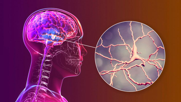 New powerful MRI scanners may help to treat Parkinson's disease better