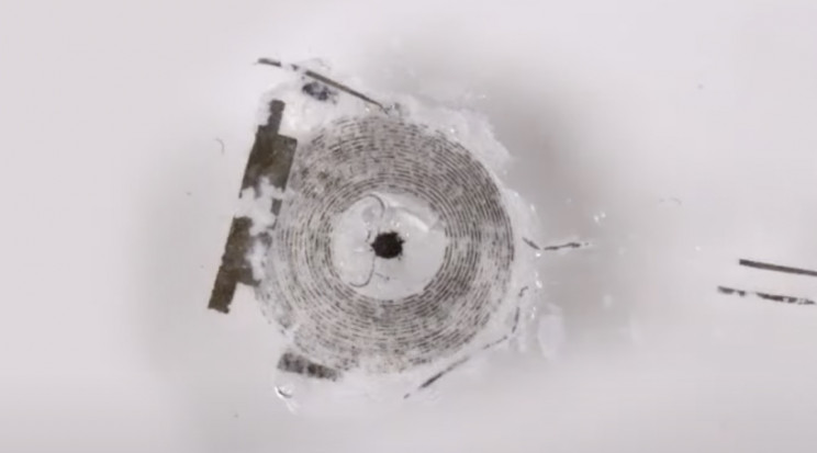 This temporary pacemaker melts away once the job is done