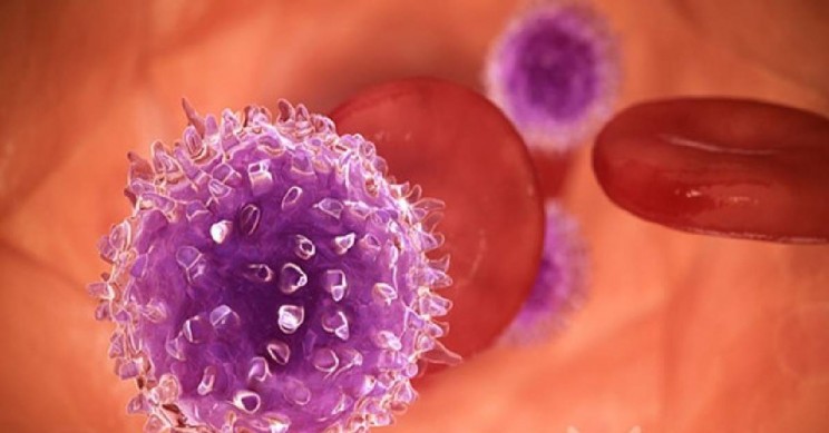 International Team of Researchers Revives Hopes For Future Leukemia Treatment