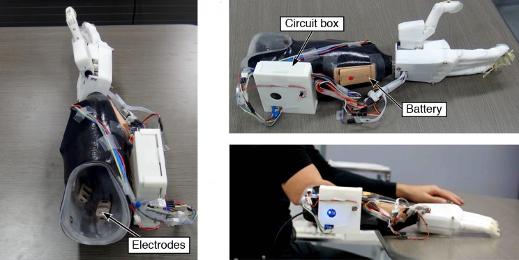 A New Prosthetic Hand System Allows Greater Accuracy and Minimal Training