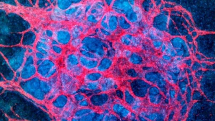 A novel kidney-building technology could transform replacement therapies