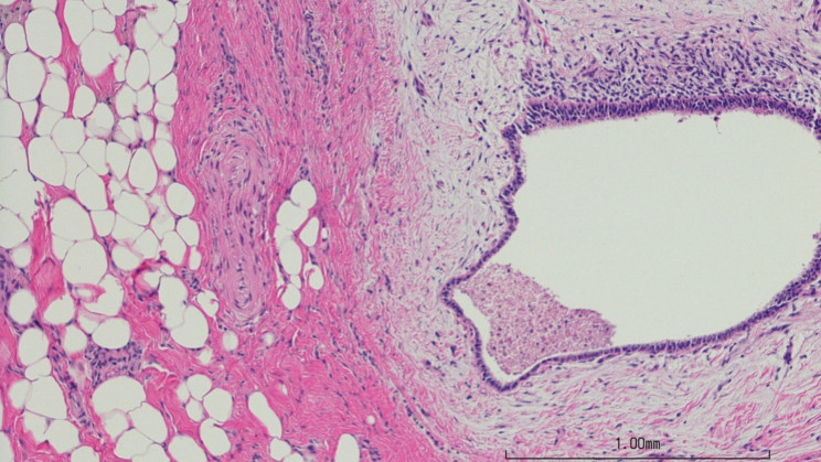 Scientists Are One Step Closer to Curing a Painful Disease Afflicting Millions of Women