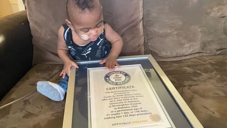 Born at 21 Weeks, This Boy Just Became the World's Most Premature Baby