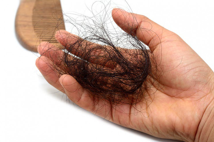 radiologists health problems hair loss