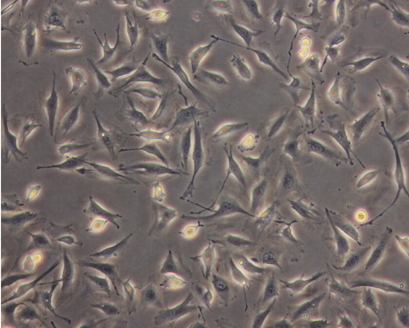 New ESA-Assisted Experiment Grows Human Tissue in Space New ESA-Assisted Experiment Grows Human Tissue in Space