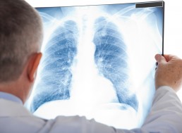 Hair-Sized Probe Could Help Discover Lung Diseases