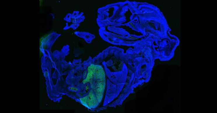 Human-Mouse Chimera Created by Scientists