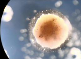 Tiny “Living” Robots Made from Frog Cells Could Be Swimming Inside You Soon