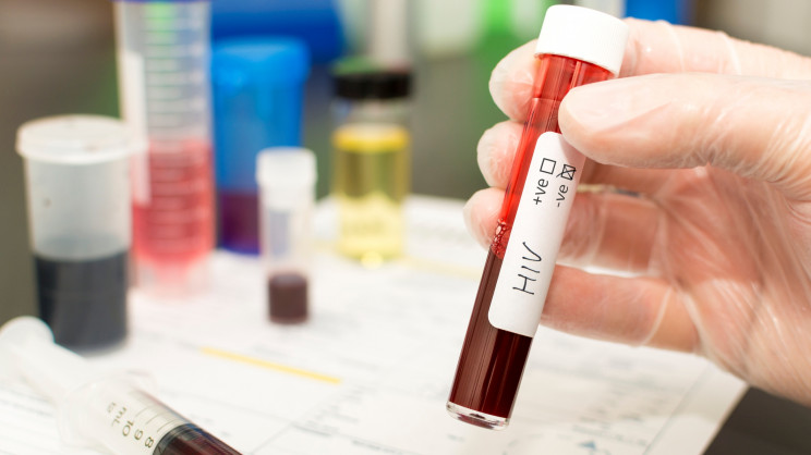 Scientists use CRISPR systems to develop a novel treatment method for HIV