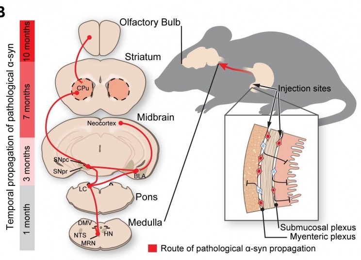 Research Provides New Evidence that Parkinson's Disease Originates in the Gut Research Provides New Evidence that Parkinson's Disease Originates in the Gut