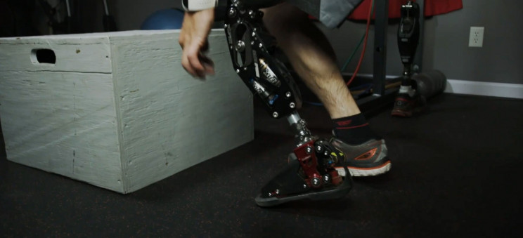 sandvik prosthetics