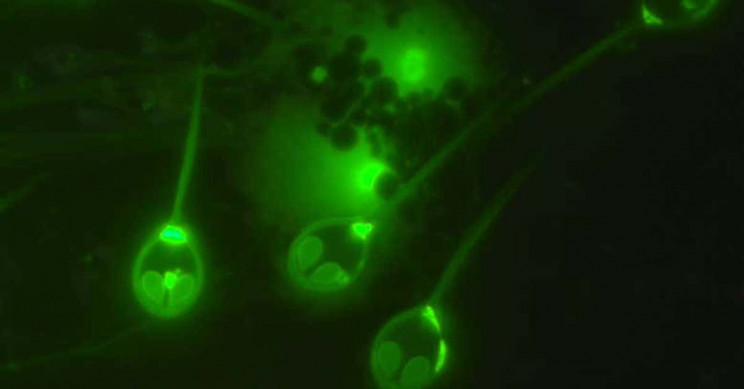 This Little Animal Needs No Oxygen to Survive, Scientists Discover