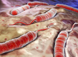 The Blue Death: How Cholera Got This Name