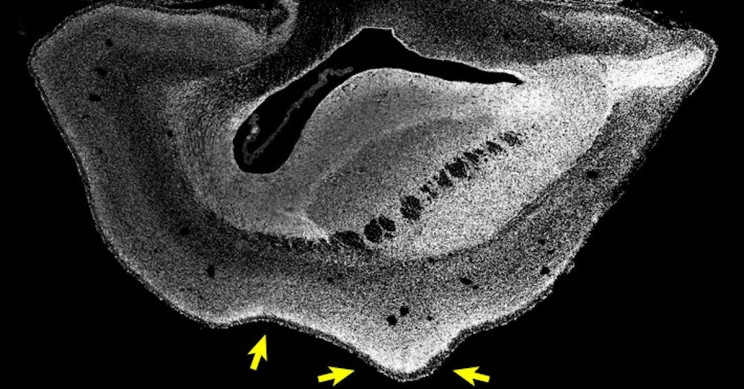 Científicos hacen crecer cerebros de mono más grandes utilizando genes humanos, replicando la evolución Científicos hacen crecer cerebros de mono más grandes utilizando genes humanos, replicando la evolución